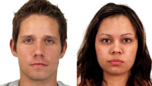 facial scars have minimal influence on attractiveness - two faces